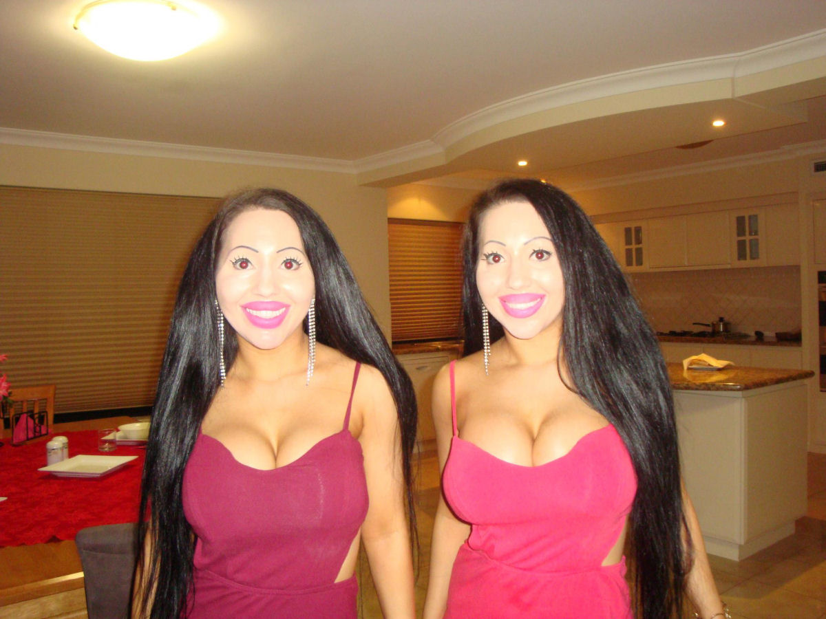 Gêmeas idênticas australianas compartilham de tudo: desde namorado até cirurgias plásticas 26