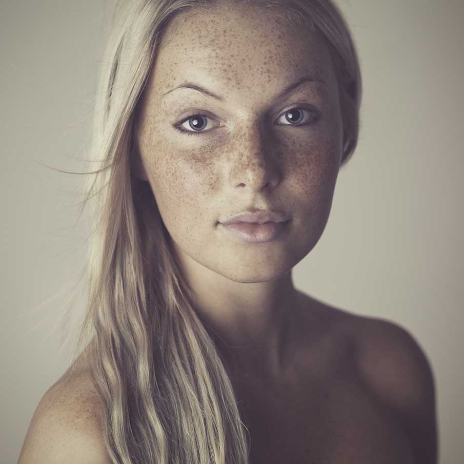 A beleza das sardentas