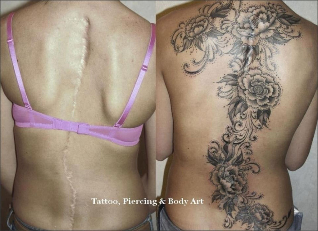 Tatuagens sobre cicatrizes mostram uma maneira incrvel de dissimul-las 02
