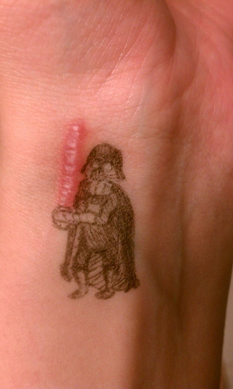 Tatuagens sobre cicatrizes mostram uma maneira incrvel de dissimul-las 03