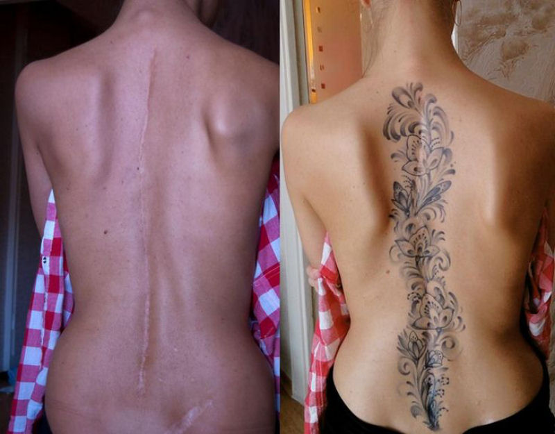 Tatuagens sobre cicatrizes mostram uma maneira incrvel de dissimul-las 04