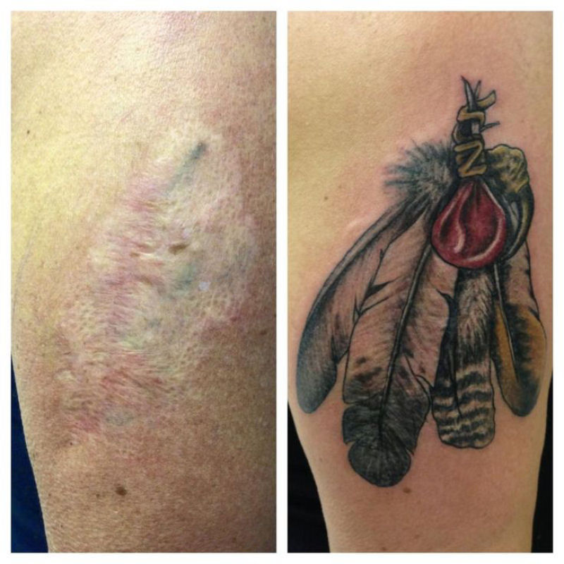 Tatuagens sobre cicatrizes mostram uma maneira incrvel de dissimul-las 06
