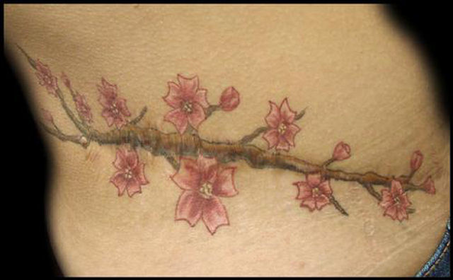 Tatuagens sobre cicatrizes mostram uma maneira incrvel de dissimul-las 07