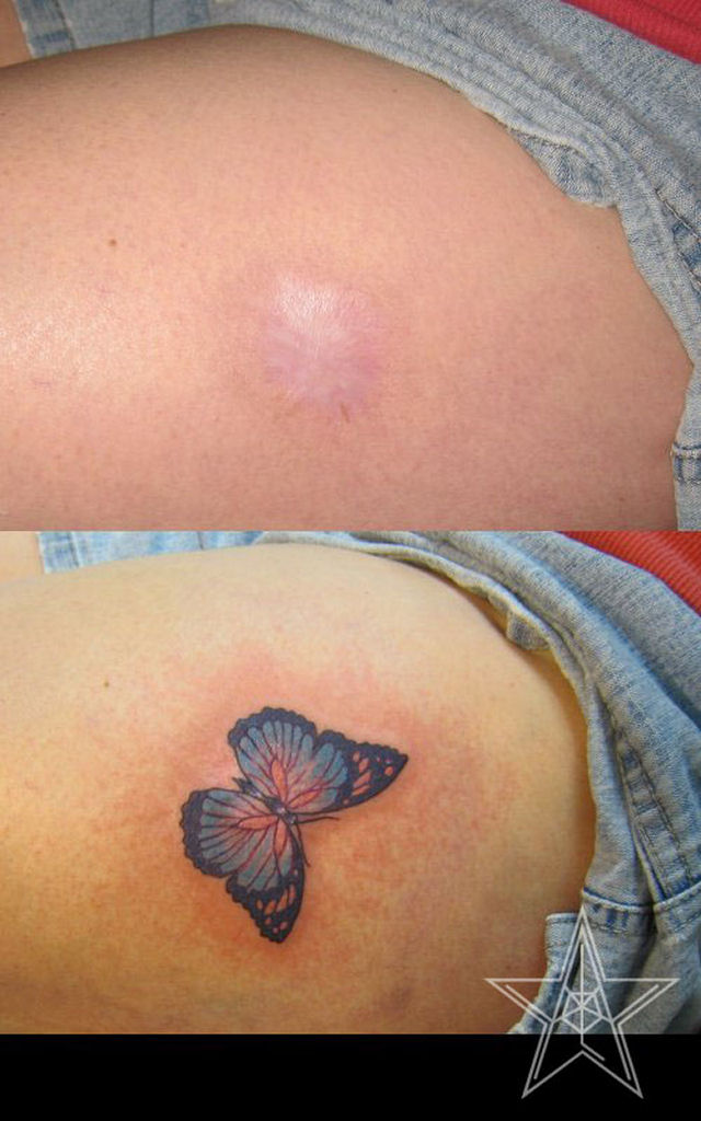 Tatuagens sobre cicatrizes mostram uma maneira incrvel de dissimul-las 12