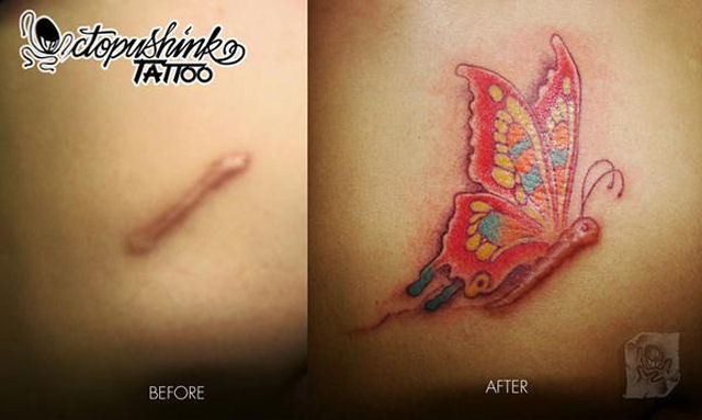 Tatuagens sobre cicatrizes mostram uma maneira incrvel de dissimul-las 13