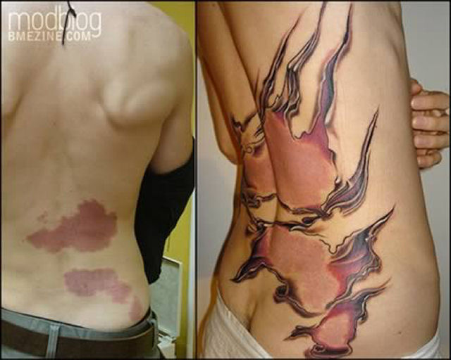 Tatuagens sobre cicatrizes mostram uma maneira incrvel de dissimul-las 15