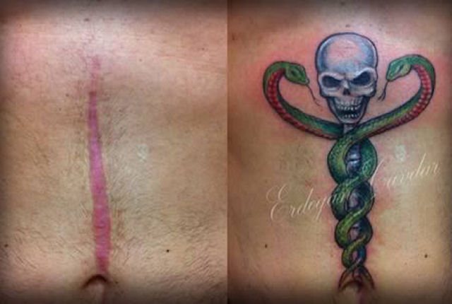 Tatuagens sobre cicatrizes mostram uma maneira incrvel de dissimul-las 19