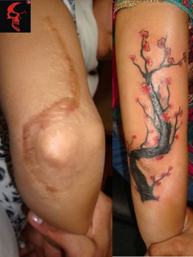 Tatuagens sobre cicatrizes mostram uma maneira incrvel de dissimul-las 20