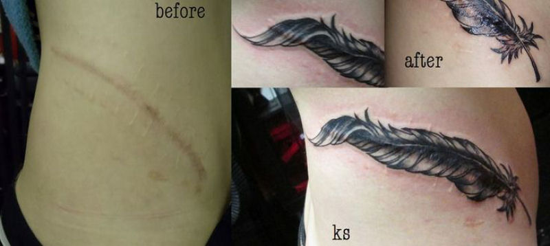 Tatuagens sobre cicatrizes mostram uma maneira incrvel de dissimul-las 21