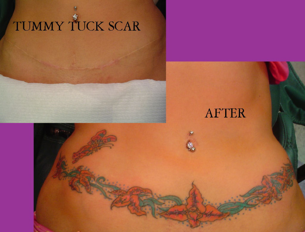 Tatuagens sobre cicatrizes mostram uma maneira incrvel de dissimul-las 22