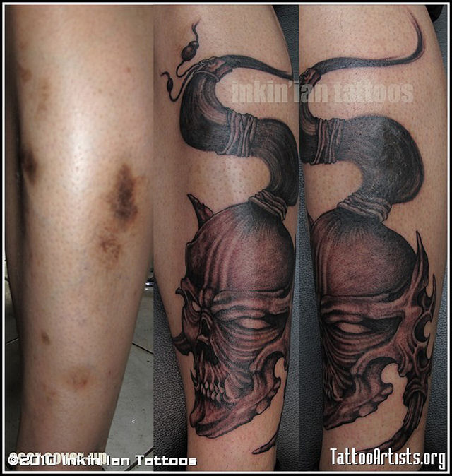 Tatuagens sobre cicatrizes mostram uma maneira incrvel de dissimul-las 23