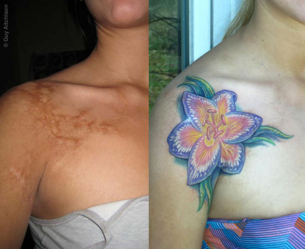 Tatuagens sobre cicatrizes mostram uma maneira incrvel de dissimul-las 24