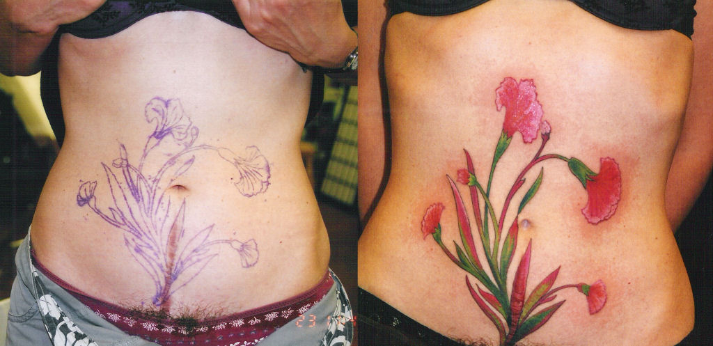 Tatuagens sobre cicatrizes mostram uma maneira incrvel de dissimul-las 26