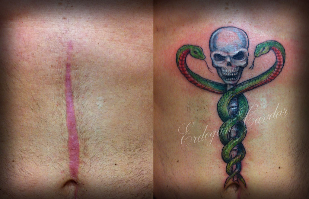 Tatuagens sobre cicatrizes mostram uma maneira incrvel de dissimul-las 27