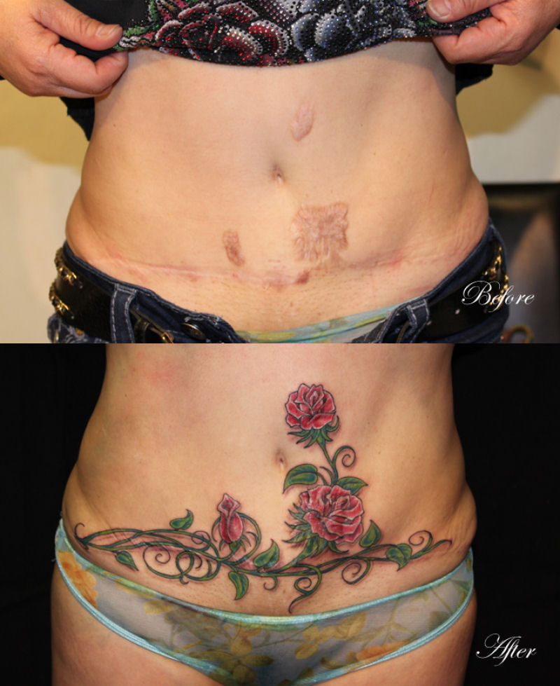 Tatuagens sobre cicatrizes mostram uma maneira incrvel de dissimul-las 31