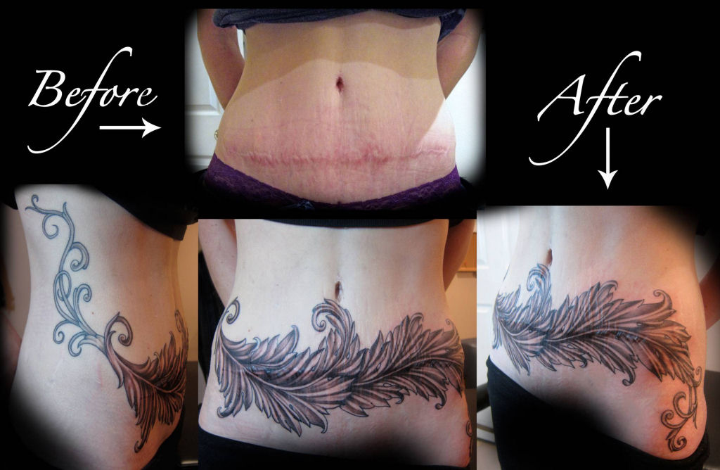 Tatuagens sobre cicatrizes mostram uma maneira incrvel de dissimul-las 33