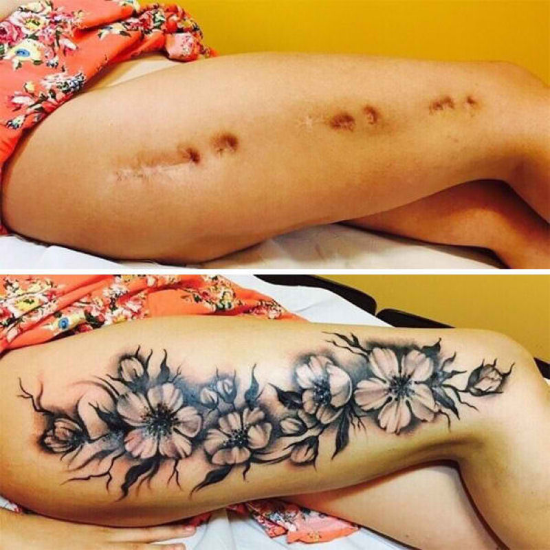 Tatuagens incríveis que cobrem cicatrizes 01