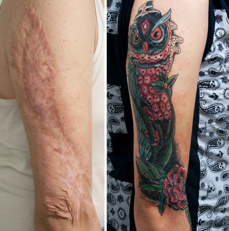 Tatuagens incríveis que cobrem cicatrizes 02