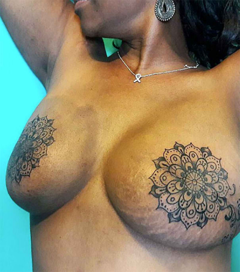 Tatuagens incríveis que cobrem cicatrizes 10