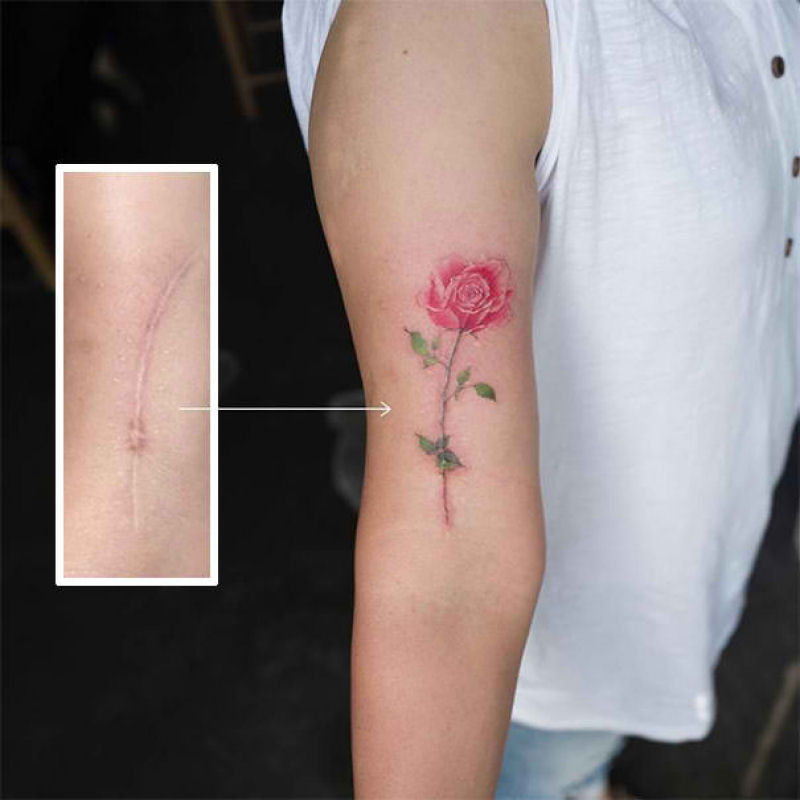 Tatuagens incríveis que cobrem cicatrizes 14