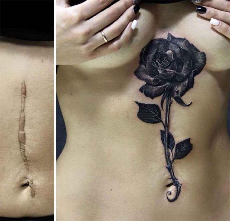 Tatuagens incríveis que cobrem cicatrizes 19