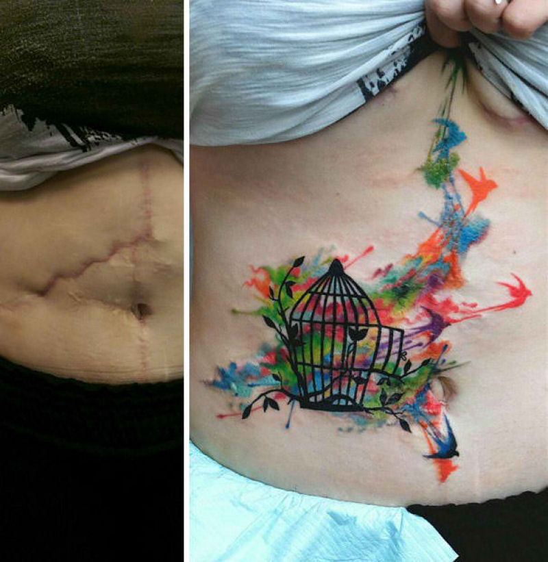Tatuagens incríveis que cobrem cicatrizes 20