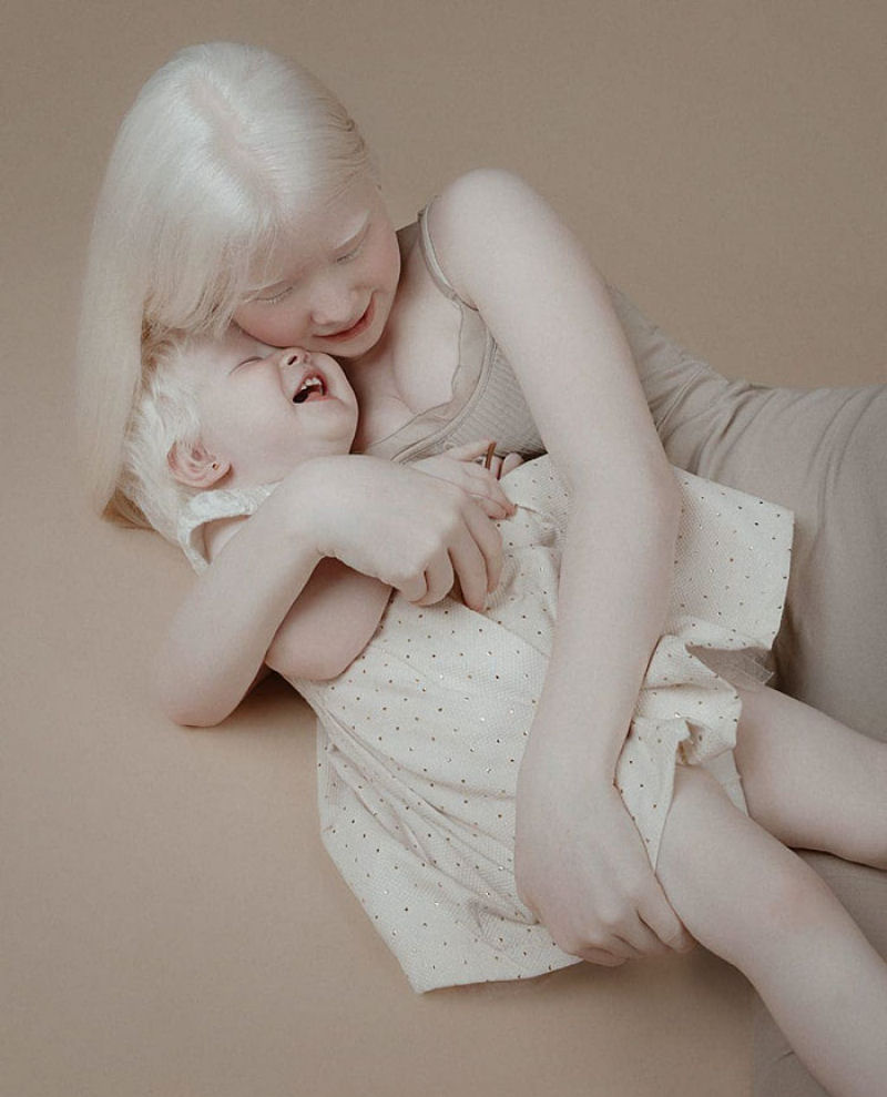A beleza surpreendente de irmãs albinas nascidas com 12 anos de diferença 02