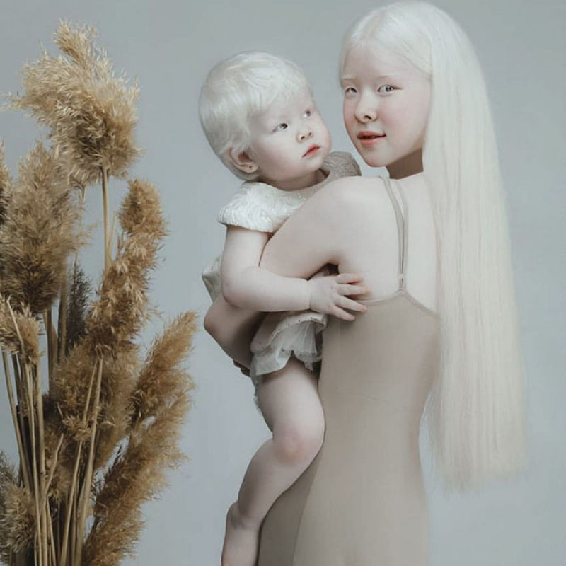 A beleza surpreendente de irmãs albinas nascidas com 12 anos de diferença 03