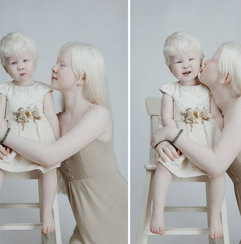 A beleza surpreendente de irmãs albinas nascidas com 12 anos de diferença 04