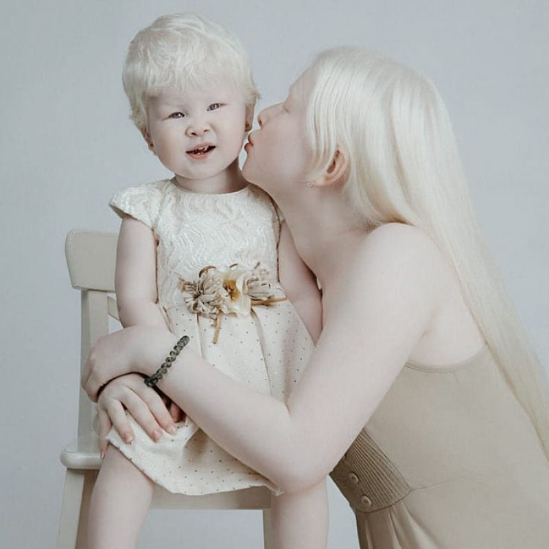 A beleza surpreendente de irmãs albinas nascidas com 12 anos de diferença 05
