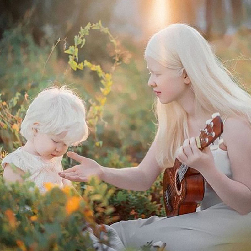 A beleza surpreendente de irmãs albinas nascidas com 12 anos de diferença 06
