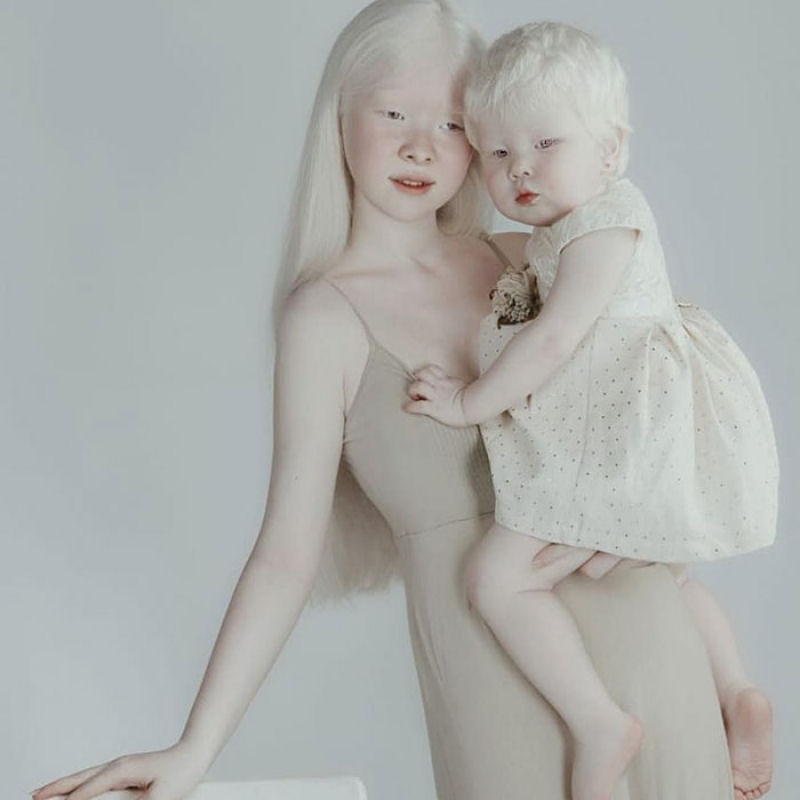A beleza surpreendente de irmãs albinas nascidas com 12 anos de diferença 08