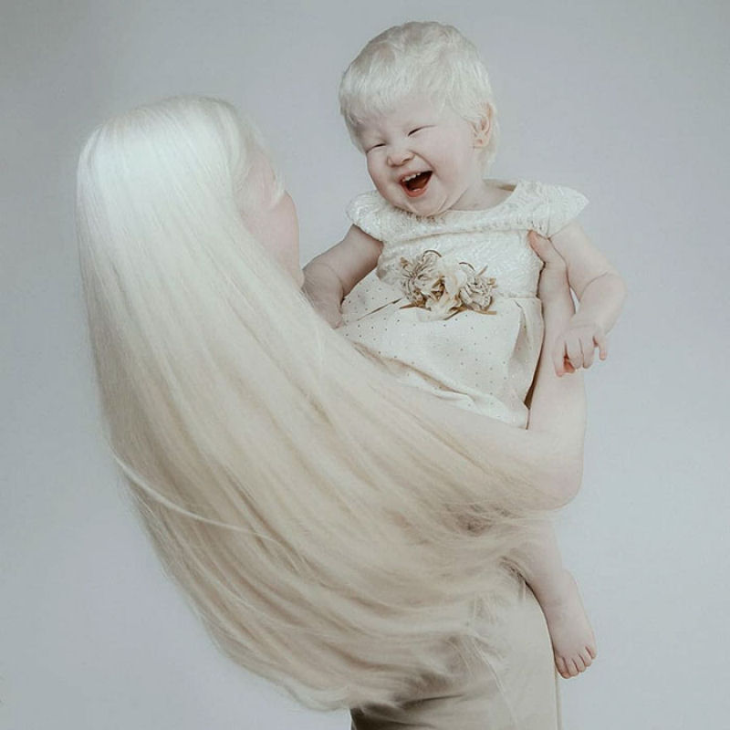 A beleza surpreendente de irmãs albinas nascidas com 12 anos de diferença 09