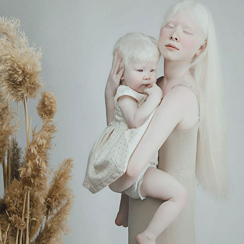 A beleza surpreendente de irmãs albinas nascidas com 12 anos de diferença 10