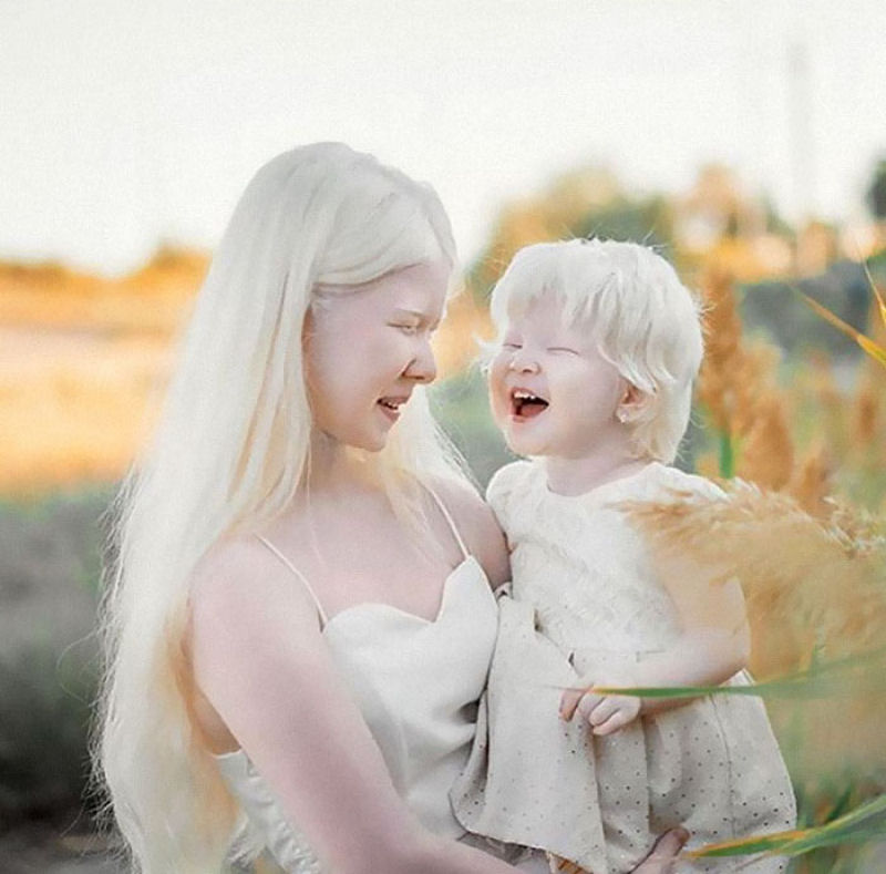A beleza surpreendente de irmãs albinas nascidas com 12 anos de diferença 11