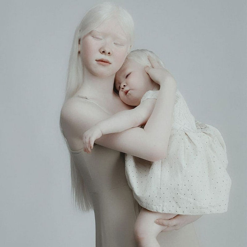 A beleza surpreendente de irmãs albinas nascidas com 12 anos de diferença 12