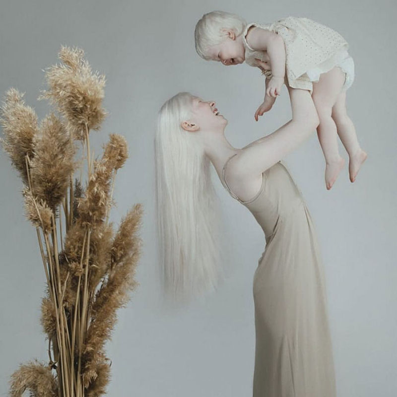 A beleza surpreendente de irmãs albinas nascidas com 12 anos de diferença 13