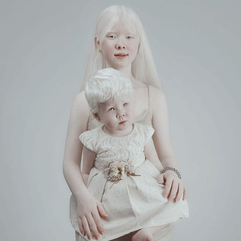 A beleza surpreendente de irmãs albinas nascidas com 12 anos de diferença 14