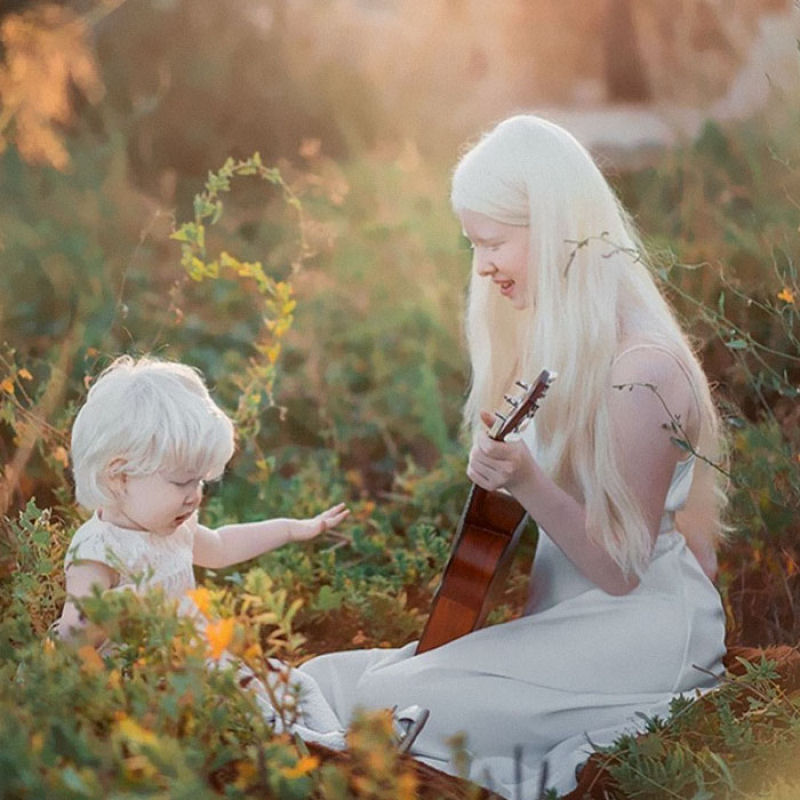 A beleza surpreendente de irmãs albinas nascidas com 12 anos de diferença 15