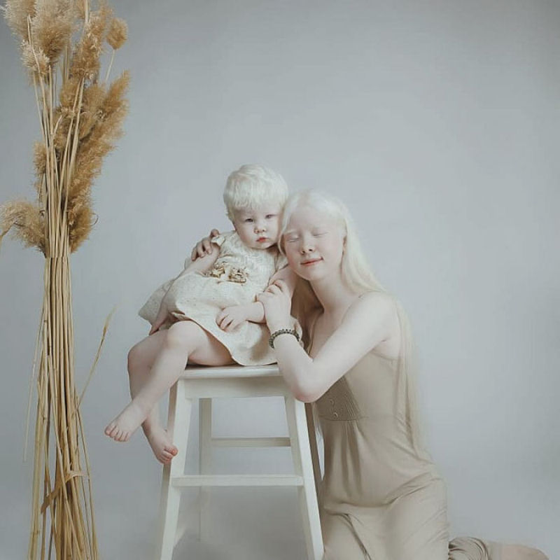 A beleza surpreendente de irmãs albinas nascidas com 12 anos de diferença 16