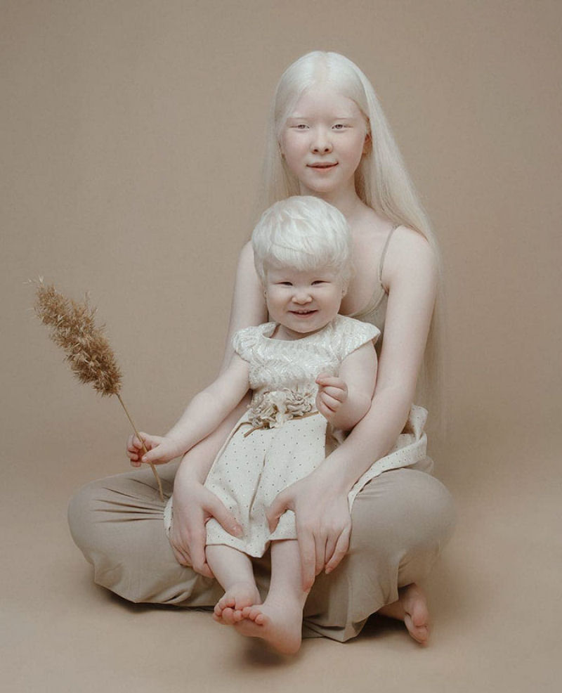A beleza surpreendente de irmãs albinas nascidas com 12 anos de diferença 17