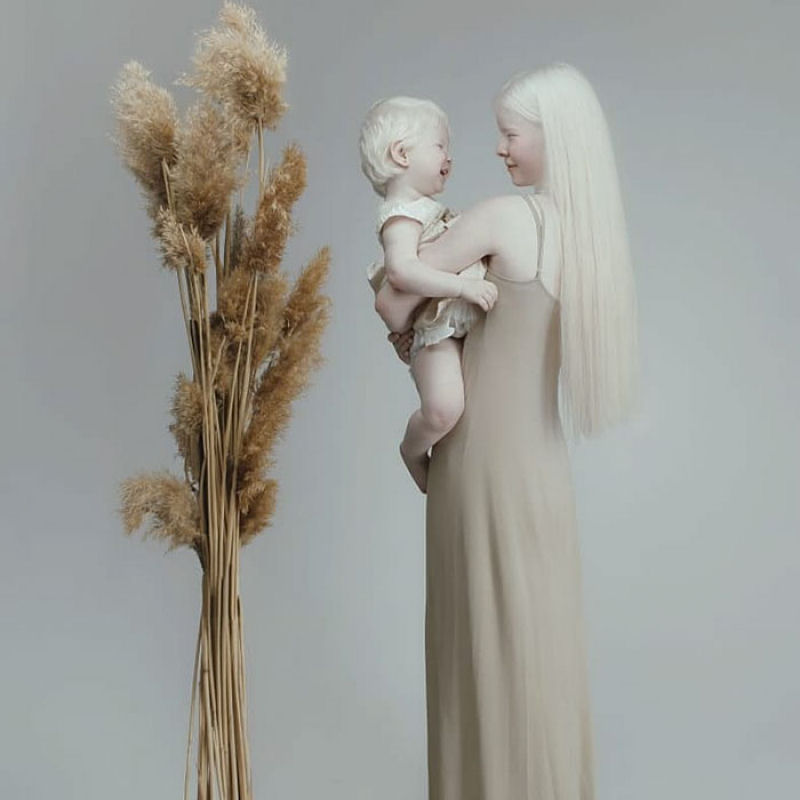 A beleza surpreendente de irmãs albinas nascidas com 12 anos de diferença 20