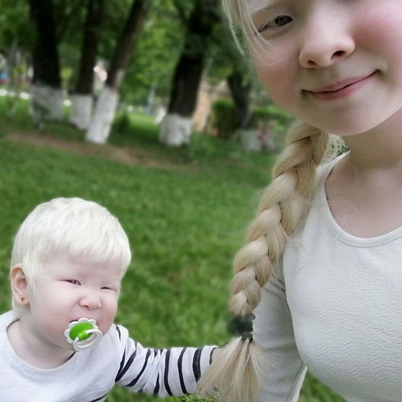 A beleza surpreendente de irmãs albinas nascidas com 12 anos de diferença 21