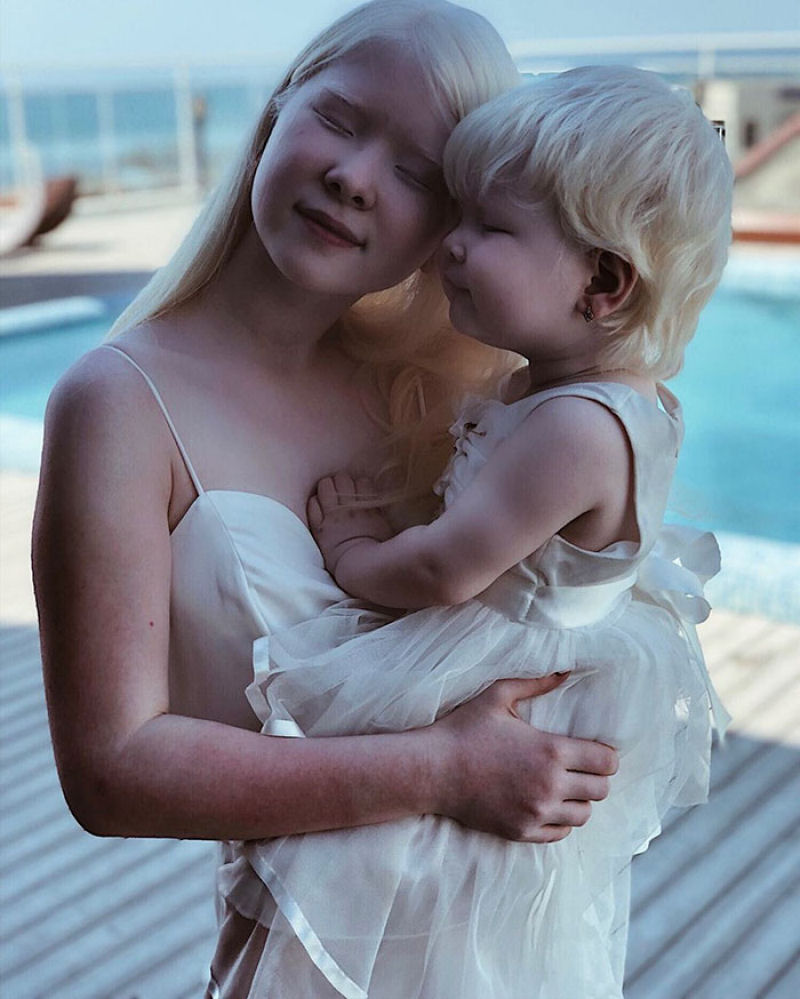 A beleza surpreendente de irmãs albinas nascidas com 12 anos de diferença 22