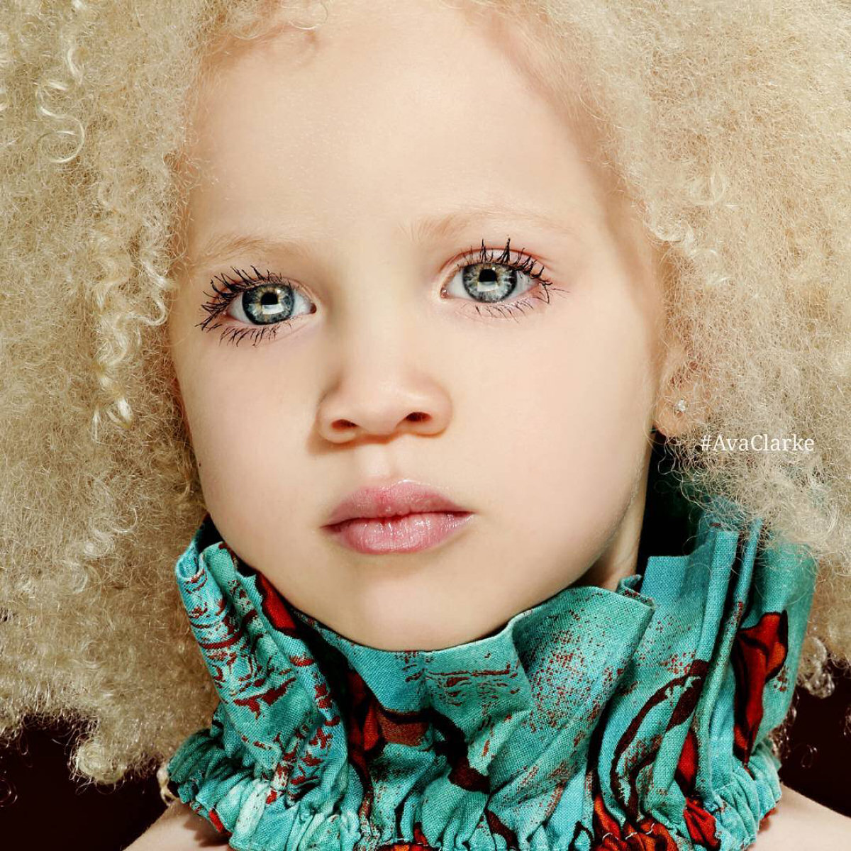 Conhea Ava Clarke, uma linda menina negra com albinismo 01