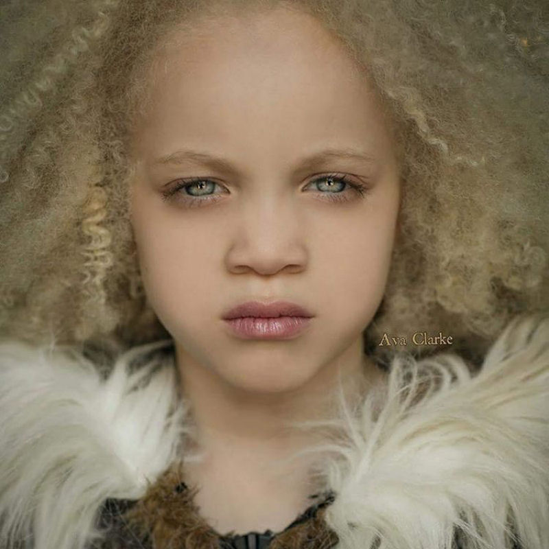 Conhea Ava Clarke, uma linda menina negra com albinismo 02