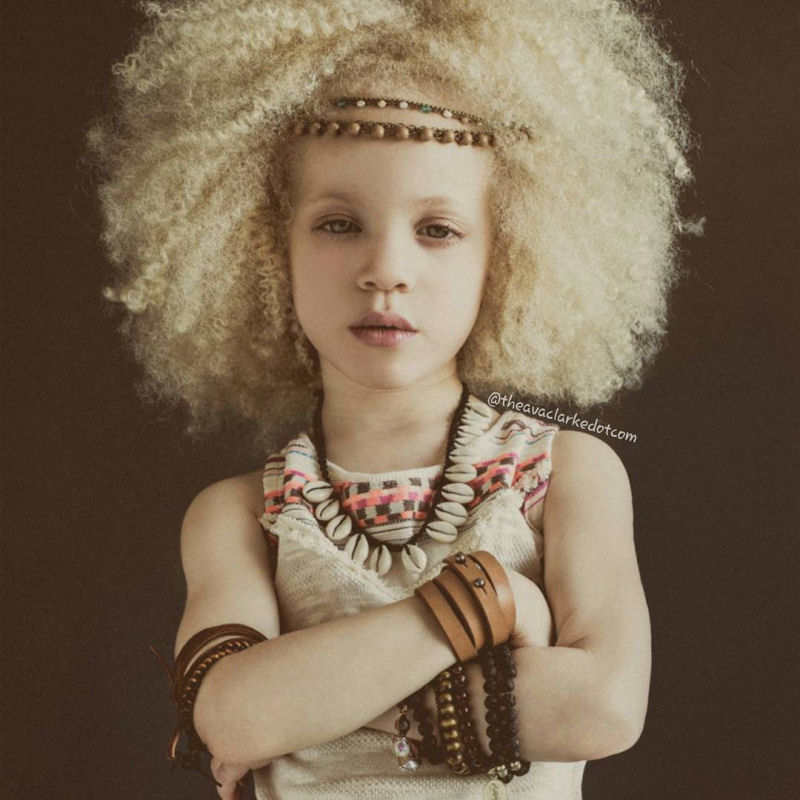 Conhea Ava Clarke, uma linda menina negra com albinismo 03