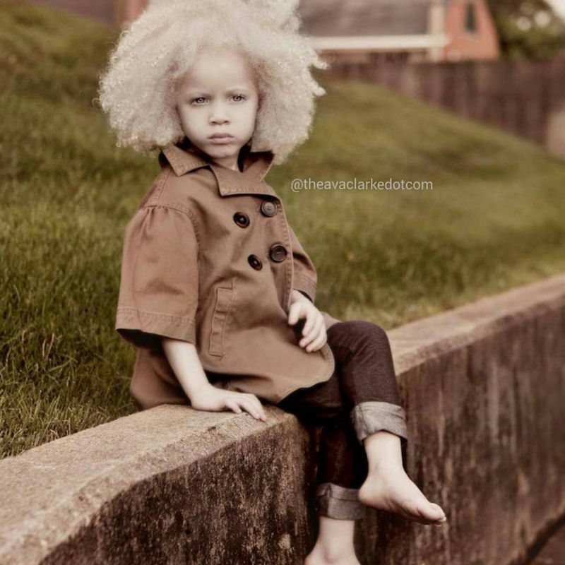 Conhea Ava Clarke, uma linda menina negra com albinismo 04