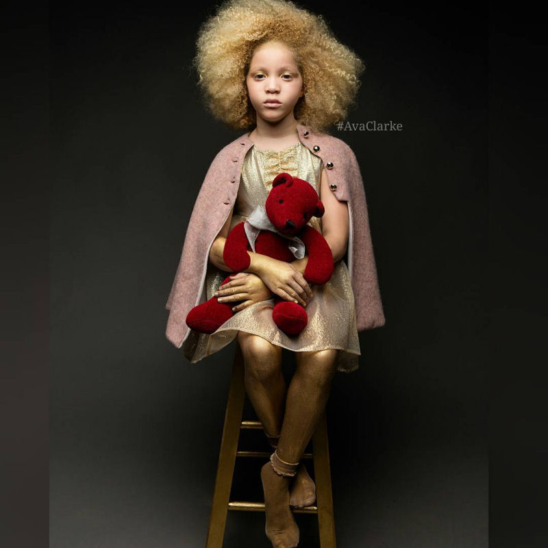 Conhea Ava Clarke, uma linda menina negra com albinismo 05
