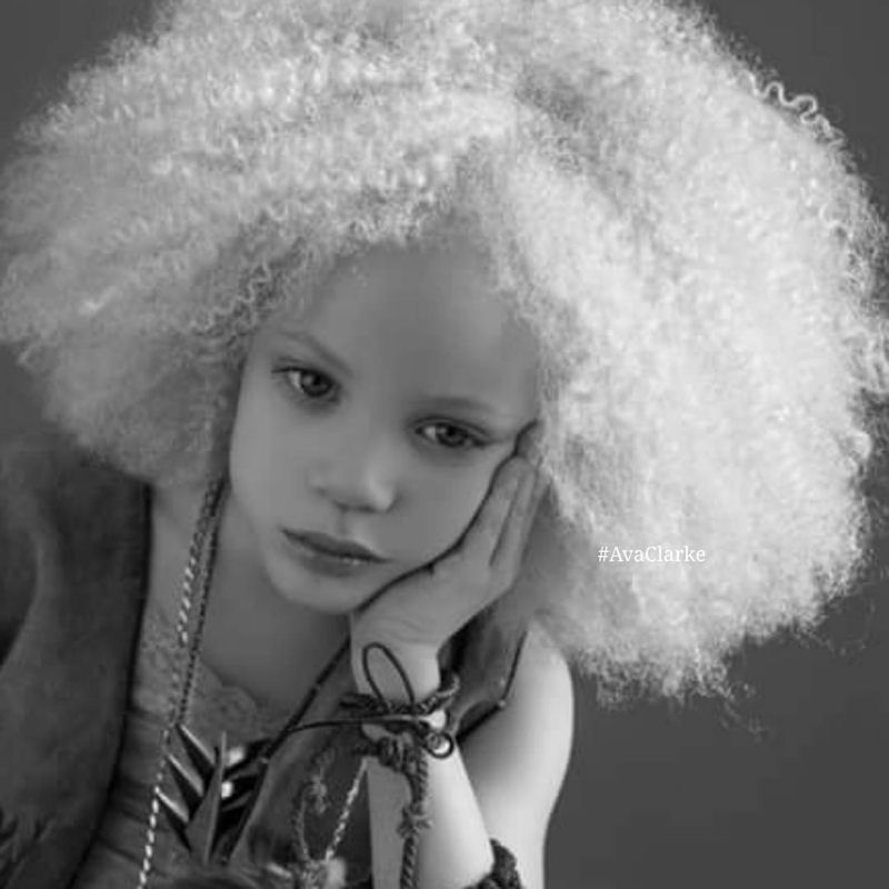 Conhea Ava Clarke, uma linda menina negra com albinismo 06